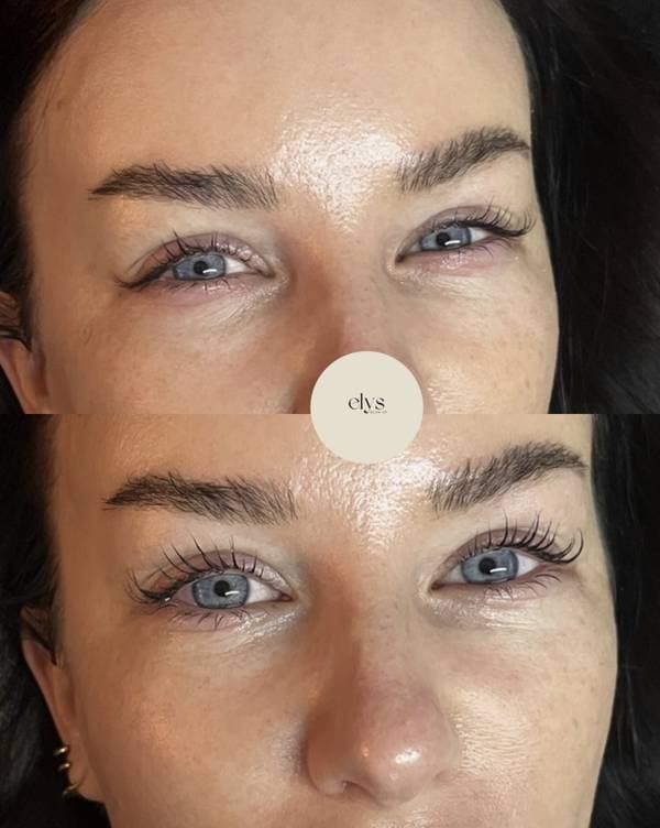 Vorher Nachher – Wimpern Lifting